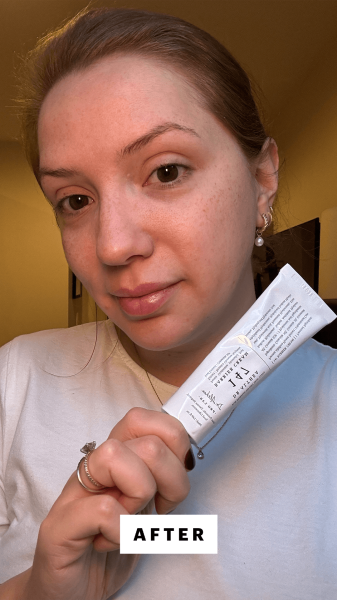 Silva after applying the Dr. Althea 147 Barrier Cream